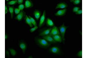 anti-WW Domain Containing Oxidoreductase (WWOX) (AA 1-180) antibody