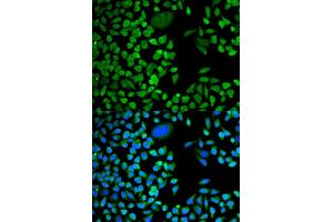 Immunofluorescence (IF) image for anti-TIA1 Cytotoxic Granule-Associated RNA Binding Protein (TIA1) antibody (ABIN1882364) (TIA1 anticorps)