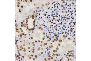 Immunohistochemistry of paraffin-embedded human kidney using TriMethyl-Histone H3-K9 antibody. (Histone 3 anticorps  (H3K9me3))