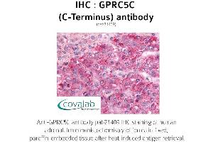 Image no. 1 for anti-G Protein-Coupled Receptor, Family C, Group 5, Member C (GPRC5C) (C-Term), (Cytoplasmic Domain) antibody (ABIN1735220)