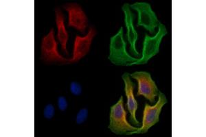 ABIN6255389 and ABIN6267301 staining H2O2 treated Hela cells by IF/ICC.