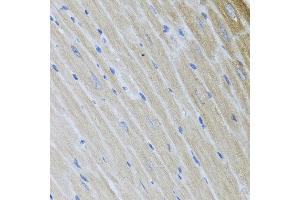 Immunohistochemistry of paraffin-embedded mouse heart using USP25 antibody at dilution of 1:100 (x40 lens). (USP25 anticorps)