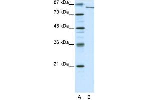 WB Suggested Anti-FBXL11 Antibody Titration: 0. (KDM2A anticorps  (N-Term))