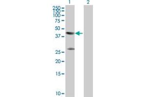 Western Blot analysis of CKM expression in transfected 293T cell line by CKM MaxPab polyclonal antibody. (CKM anticorps  (AA 1-381))