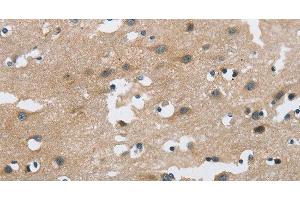 Immunohistochemistry of paraffin-embedded Human brain using FGF9 Polyclonal Antibody at dilution of 1:40