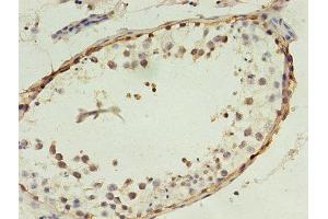 Immunohistochemistry of paraffin-embedded human testis tissue using ABIN7159264 at dilution of 1:100 (MAGEA4 anticorps  (AA 1-270))