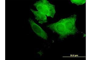 Immunofluorescence of purified MaxPab antibody to ECH1 on HeLa cell.