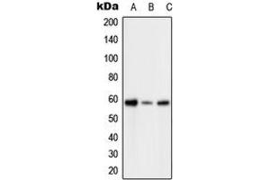 Western blot analysis of PFKFB2 (pS483) expression in HeLa H2O2-treated (A), SP2/0 H2O2-treated (B), H9C2 H2O2-treated (C) whole cell lysates. (PFKFB2 anticorps  (C-Term, pSer483))
