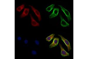 ABIN7094634 and ABIN7098684 staining Hela cells by IF/ICC.