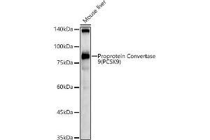 Western blot analysis of extracts of Mouse liver, using Proprotein Convertase 9(PCSK9) antibody (ABIN6133851, ABIN6145328, ABIN6145330 and ABIN6223837) at 1:1000 dilution. (PCSK9 anticorps  (C-Term))