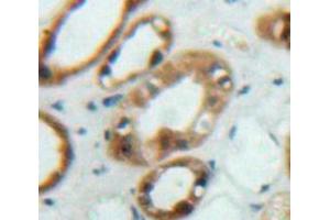 Used in DAB staining on fromalin fixed paraffin-embedded Kidney tissue (FRS2 anticorps  (AA 268-453))