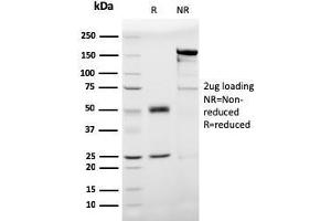 SDS-PAGE Analysis Purified Prohibitin Mouse Monoclonal Antibody (PHB/3193). (Prohibitin anticorps  (AA 167-261))