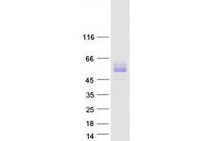 Validation with Western Blot