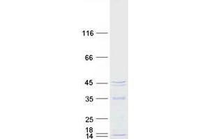 Validation with Western Blot
