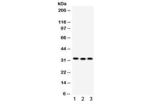 Western blot testing of 1) rat liver, 2) mouse spleen and 3) human MCF7 lysate with C1QBP antibody. (C1QBP anticorps)