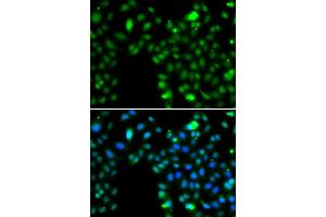 Immunofluorescence analysis of MCF-7 cells using ING5 antibody. (ING5 anticorps)
