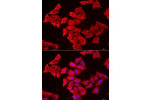 Immunofluorescence analysis of HeLa cells using SMPX antibody (ABIN6292730).