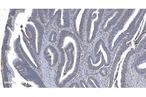 IHC analysis of ARG2 using anti-ARG2 antibody (ABIN7602662).