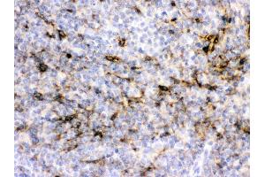 Alpha A Crystallin was detected in paraffin-embedded sections of rat spleen tissues using rabbit anti- Alpha A Crystallin Antigen Affinity purified polyclonal antibody (Catalog # ) at 1 ?