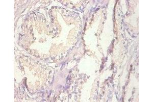 Immunohistochemistry of paraffin-embedded human prostate tissue using ABIN7159509 at dilution of 1:100 (MT1A anticorps  (AA 1-59))