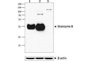 Western Blotting (WB) image for anti-Granzyme B (GZMB) (AA 21-247) antibody (ABIN2666250) (GZMB anticorps  (AA 21-247))