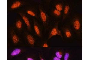 Immunofluorescence analysis of U2OS cells using HSPA2 Polyclonal Antibody at dilution of 1:100. (HSPA2 anticorps)