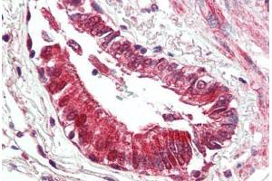Human Lung, Respiratory Epithelium (formalin-fixed, paraffin-embedded) stained with BECN1 antibody ABIN461895 at 5 ug/ml followed by biotinylated goat anti-rabbit IgG secondary antibody ABIN481713, alkaline phosphatase-streptavidin and chromogen. (Beclin 1 anticorps  (N-Term))