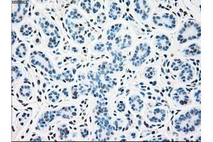 Immunohistochemical staining of paraffin-embedded breast tissue using anti-SSB mouse monoclonal antibody. (SSB anticorps)