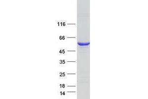 Validation with Western Blot