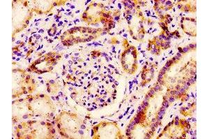 IHC image of ABIN7164824 diluted at 1:400 and staining in paraffin-embedded human kidney tissue performed on a Leica BondTM system.