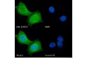 anti-Zinc Finger Protein 217 (ZNF217) (Internal Region) antibody