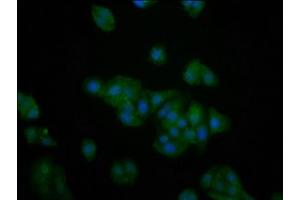 Immunofluorescence staining of HepG2 cells with ABIN7142697 at 1:200, counter-stained with DAPI. (PFKFB4 anticorps  (AA 266-368))