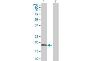 Western Blot analysis of ANK1 expression in transfected 293T cell line by ANK1 MaxPab polyclonal antibody. (Erythrocyte Ankyrin anticorps  (AA 1-155))