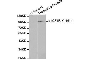 Western Blotting (WB) image for anti-Insulin-Like Growth Factor 1 Receptor (IGF1R) (pTyr1161) antibody (ABIN1870257) (IGF1R anticorps  (pTyr1161))