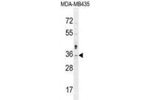 Western blot analysis in MDA-MB435 cell line lysates (35ug/lane) using Metaxin-2 Antibody (C-term). (MTX2 anticorps  (C-Term))