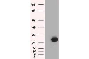 Western Blotting (WB) image for anti-Chromosome 21 Open Reading Frame 59 (C21orf59) antibody (ABIN1497042) (C21orf59 anticorps)