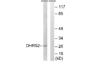 Western blot analysis of extracts from COLO cells, using DHRS2 antibody. (DHRS2 anticorps)