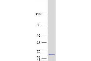 Validation with Western Blot (MED22 Protein (Transcript Variant C) (Myc-DYKDDDDK Tag))