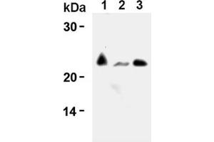 Western Blotting (WB) image for anti-CD3 (CD3) antibody (ABIN567797) (CD3 anticorps)