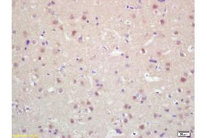 Formalin-fixed and paraffin embedded rat brain labeled with Rabbit Anti KIF20A/MKLP2 Polyclonal Antibody, Unconjugated (ABIN872316) at 1:200 followed by conjugation to the secondary antibody and DAB staining