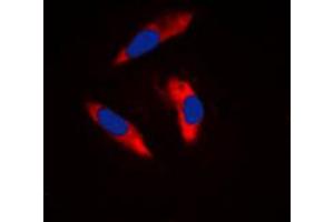 Immunofluorescent analysis of CD61 staining in Raw264.