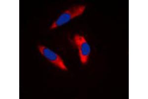 Immunofluorescent analysis of CD61 staining in Raw264. (Integrin beta 3 anticorps  (C-Term))