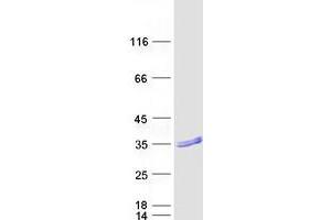 Validation with Western Blot