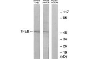 Western blot analysis of extracts from mouse lung/mouse muscle cells, using TFEB Antibody. (TFEB anticorps  (AA 10-59))