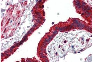 Anti-MMP14 antibody IHC of human lung, respiratory epithelium. (MMP14 anticorps  (AA 160-173))