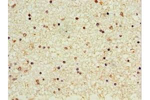 Immunohistochemistry of paraffin-embedded human brain tissue using ABIN7162964 at dilution of 1:100