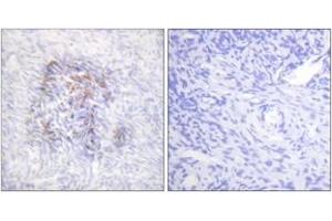 Immunohistochemistry analysis of paraffin-embedded human ovary, using IREB1 (Phospho-Ser138) Antibody. (Aconitase 1 anticorps  (pSer138))