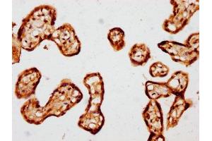 IHC image of ABIN7172758 diluted at 1:441 and staining in paraffin-embedded human placenta tissue performed on a Leica BondTM system.