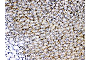 IHC analysis of Periostin using anti-Periostin antibody .