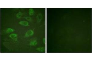 Immunofluorescence analysis of HeLa cells, using IL-2R alpha/CD25 (Phospho-Ser268) Antibody. (CD25 anticorps  (pSer268))